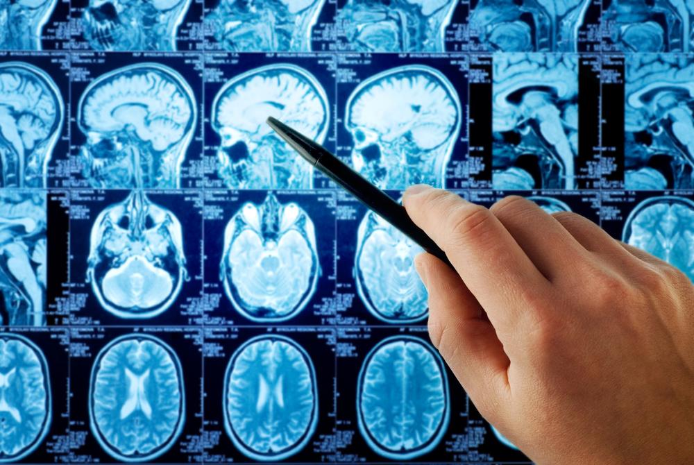 Human brain vs. AI: LSD microdosing could be key to victory