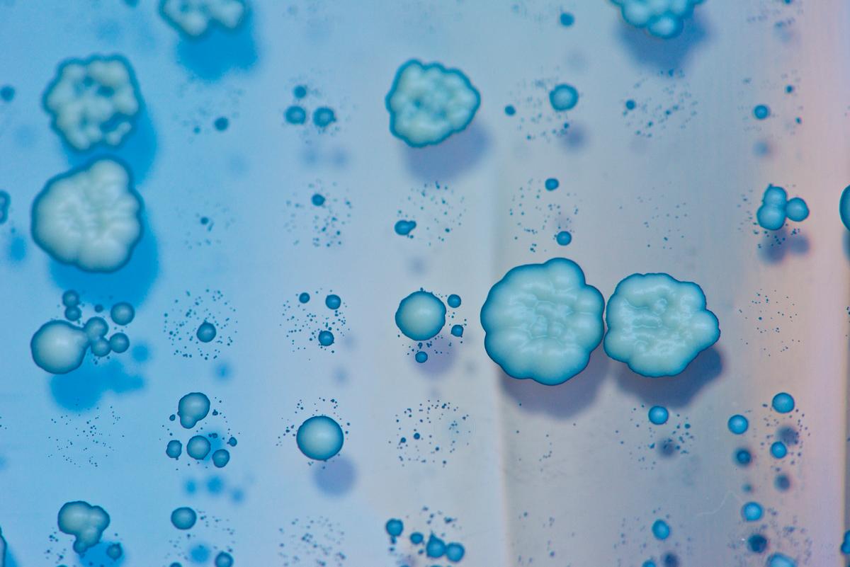Study reveals mechanism that allows cells to adapt to environment