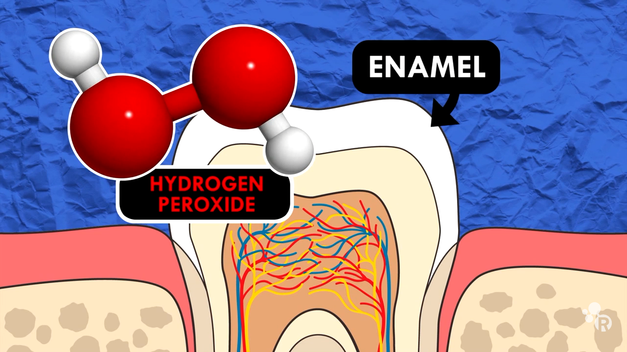 The chemistry behind teeth whitening