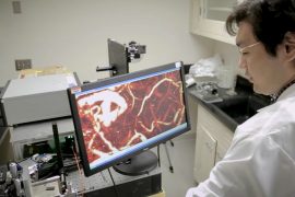 Detecting ovarian cancer in its earliest stages