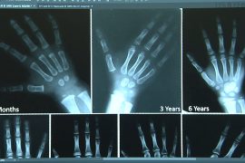 Children born in this century are growing faster