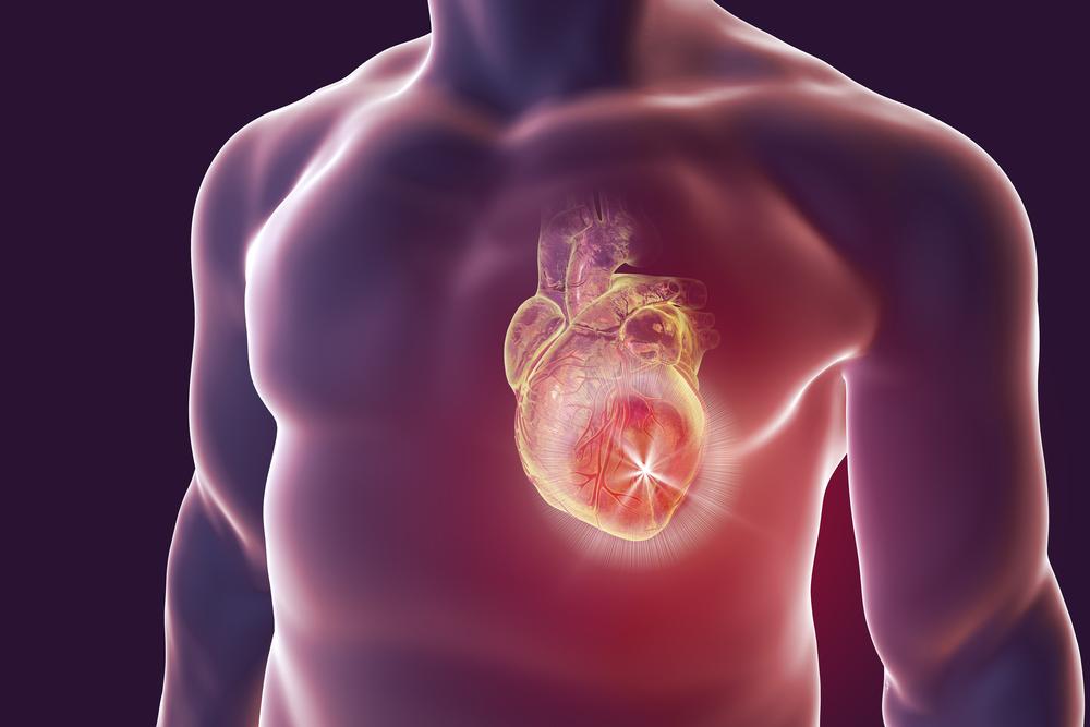 Machine learning could help prevent heart attack deaths