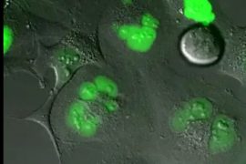 Oxidative stress speeds up cellular aging