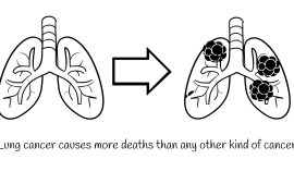 New targets identified to block lung tumor growth