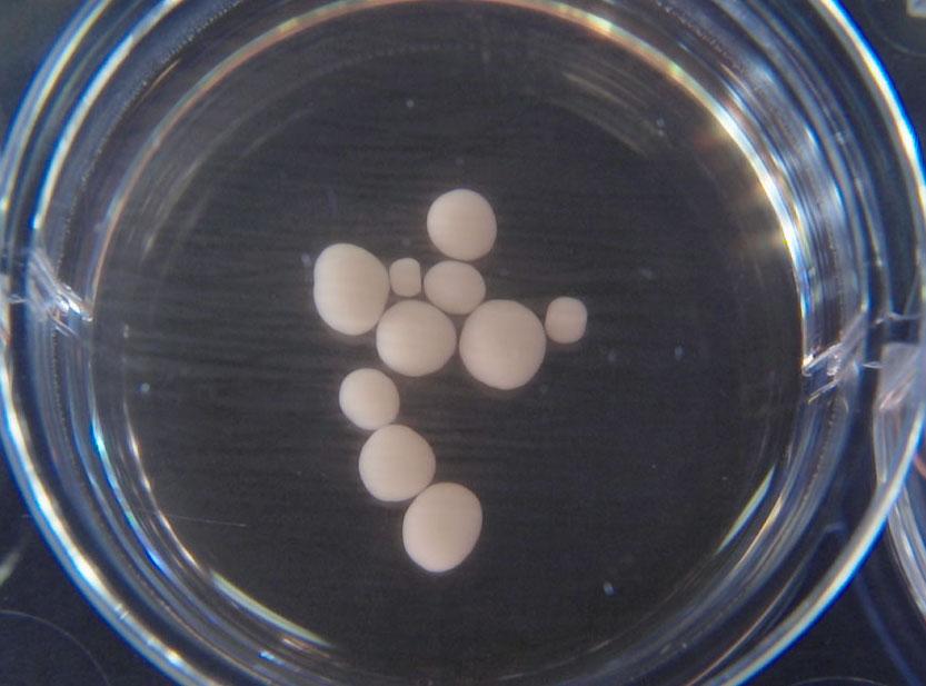 Lab-grown miniature brains produce brain waves