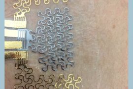 Wearable technology will improve heart monitoring