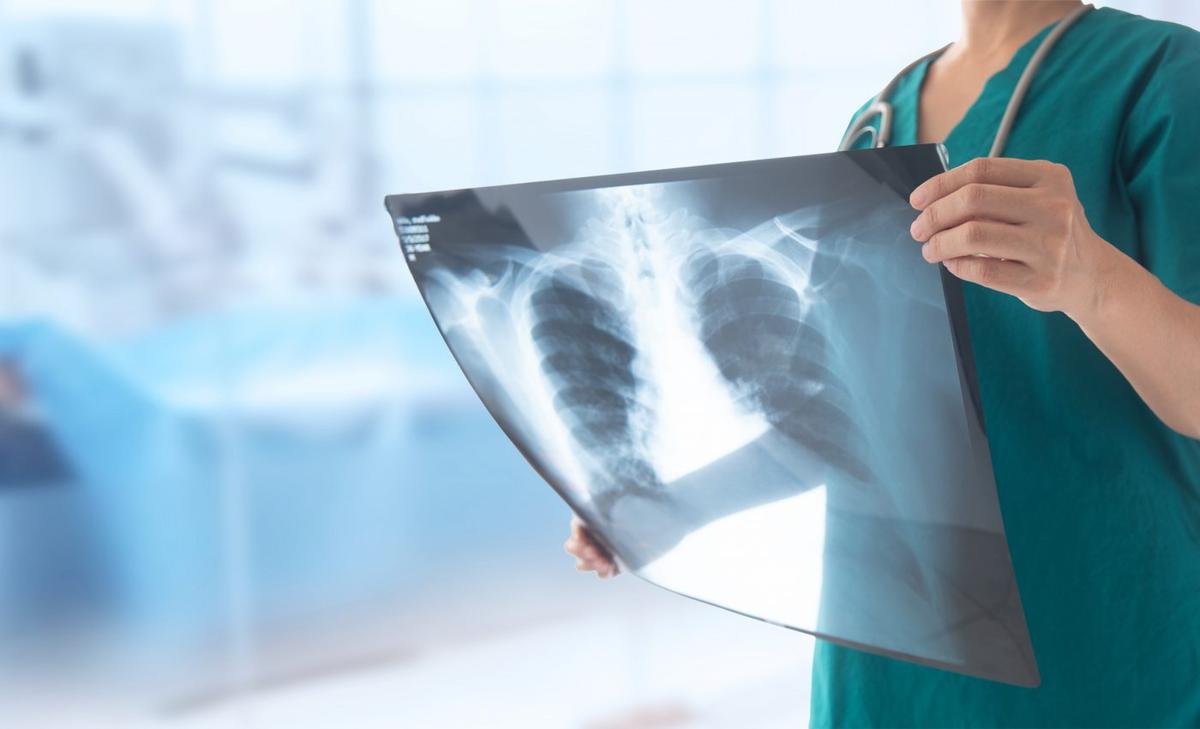 Bacteriophages could reduce COVID-19 deaths 