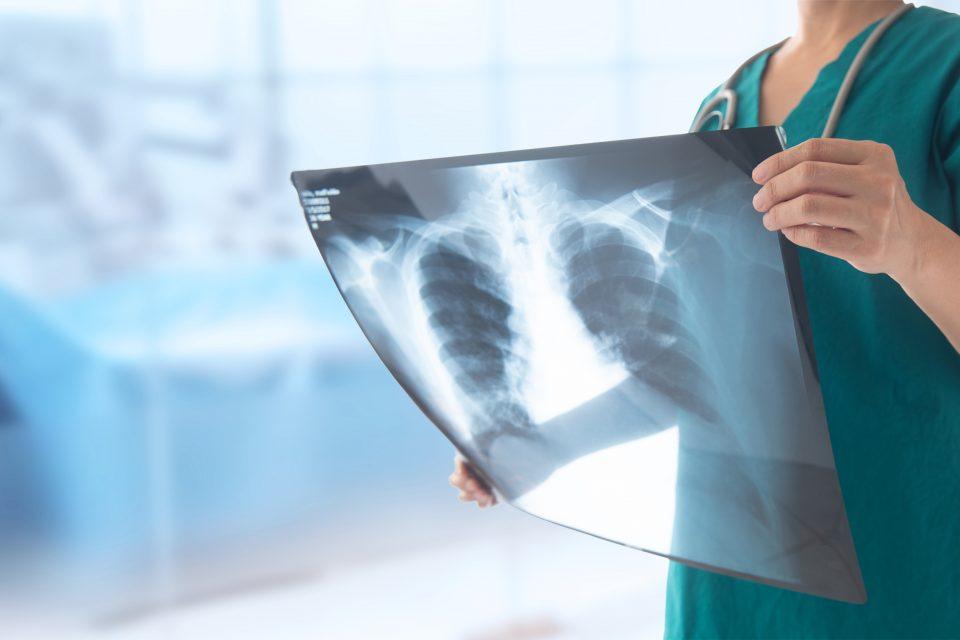Bacteriophages could reduce COVID-19 deaths 