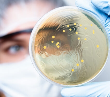 Lactobacillus,Bacteria,Colonies.,Female,Us,High,School,Student,(16,Y.o.)