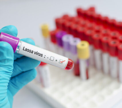 Blood,Sample,Positive,With,Lassa,Virus,Test