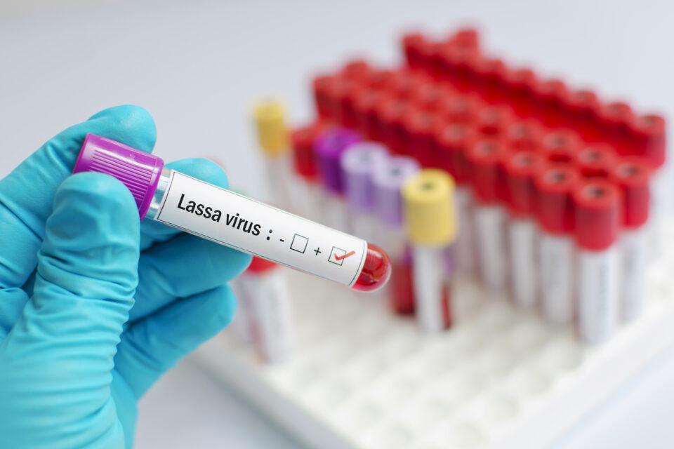 Lassa fever risk could increase dramatically in Africa