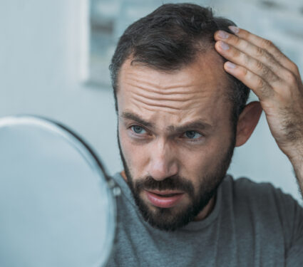 Upset,Middle,Aged,Man,With,Alopecia,Looking,At,Mirror,,Hair