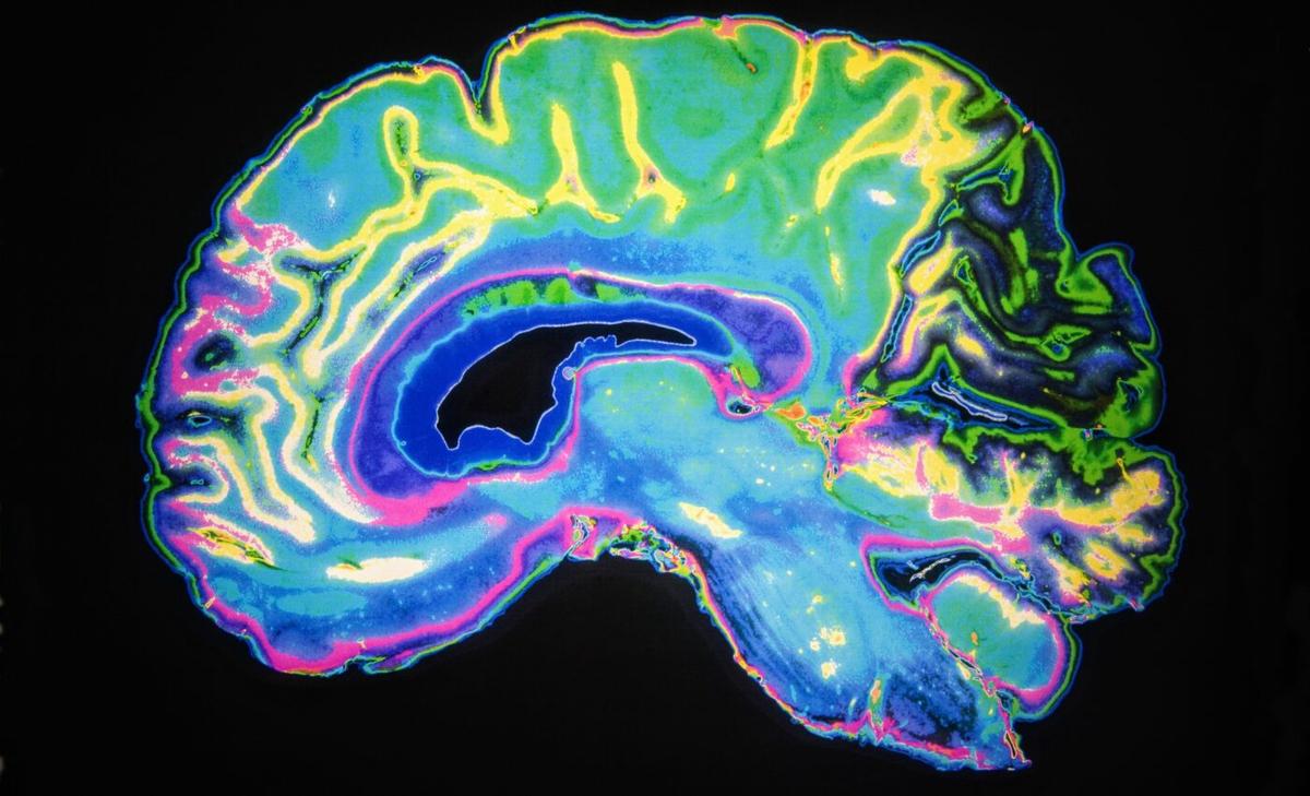 Dementia detection may be possible years before symptoms