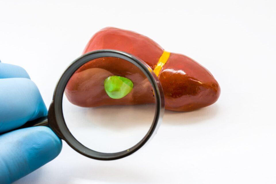 Language of the gut: The unknown potential bile acids