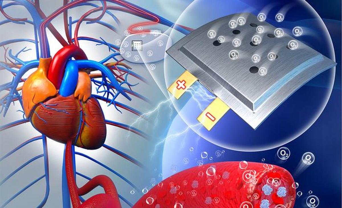 Implantable battery could run on the body’s own oxygen