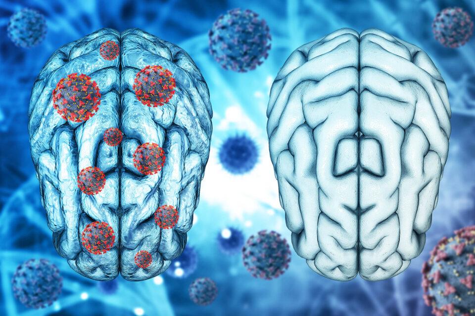 Long COVID leaves blood markers that can be targeted for treatment
