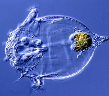 Rotifers.jpg