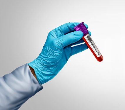 2024/08/Alzheimers-tests.jpg