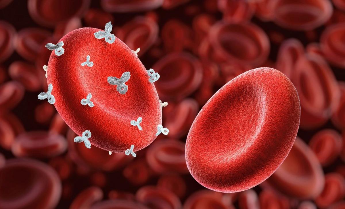 Blood type is linked to your risk of having a stroke