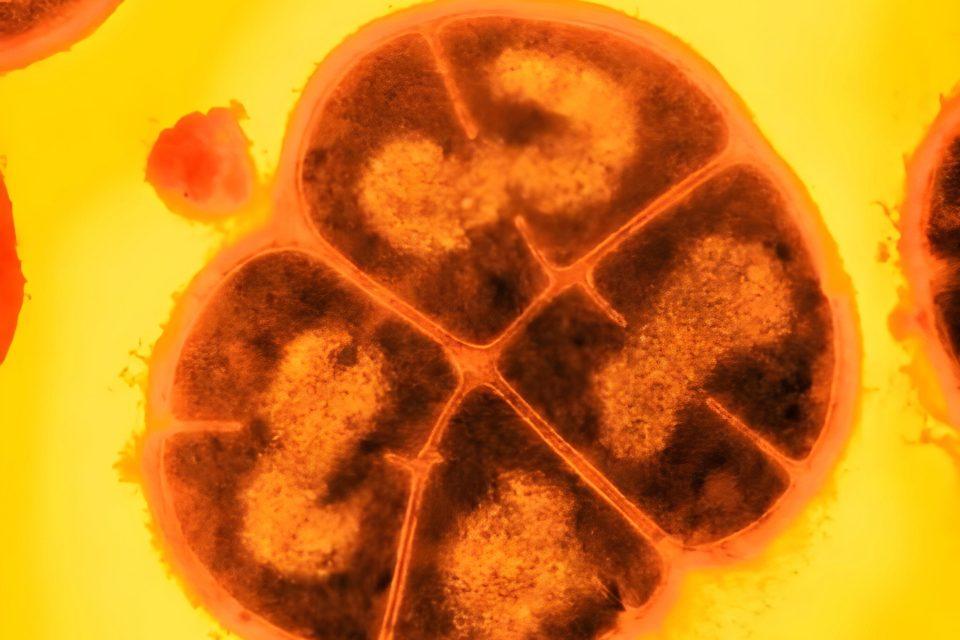 'Conan the Bacterium' can endure extreme radiation