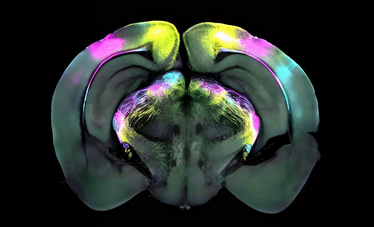 Brain pathway discovered that suppresses fear