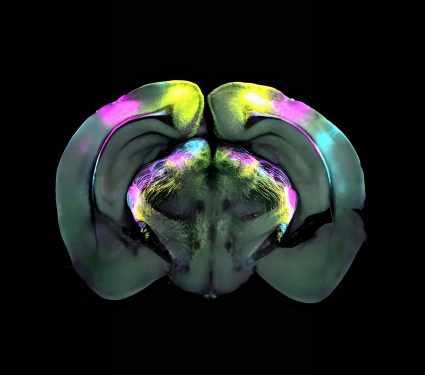 2025/02/Fear-brain-.jpg