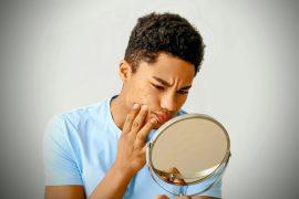 2025/05/Acne-skin-bacteria.jpg