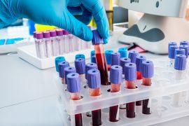 2025/06/Cancer-proteins.jpg