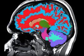 2025/07/Aging-scan.jpg