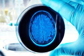 2025/07/brain_organoids_grown-in-lab_1m.jpg
