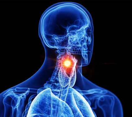 2025/08/larynx_voice-box-cancer_ai-diagnosis_1m.jpg