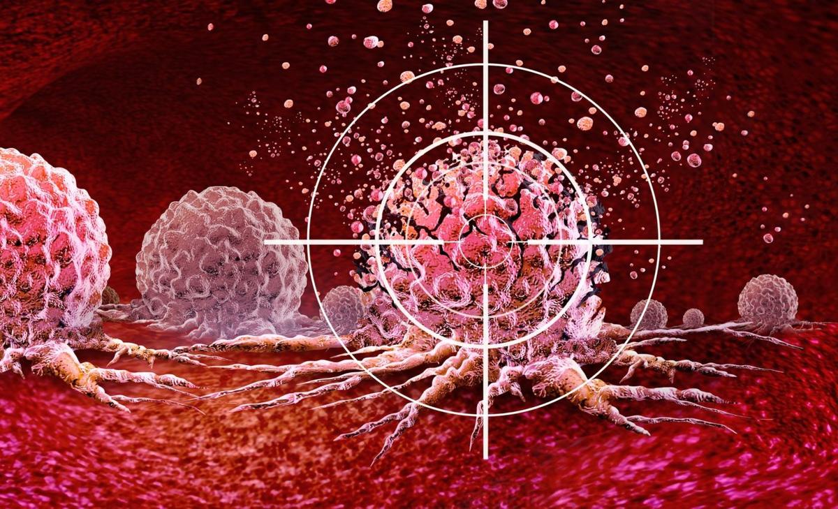 Freezing molecules could halt the spread of brain cancer