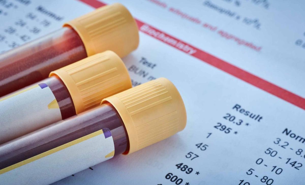 Scientists developed a blood test that identifies Alzheimer's disease in minutes