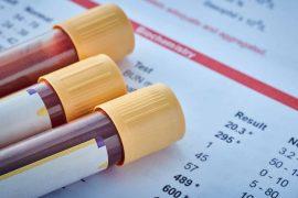 2025/09/alzheimers-blood-test-lab-sample.jpg