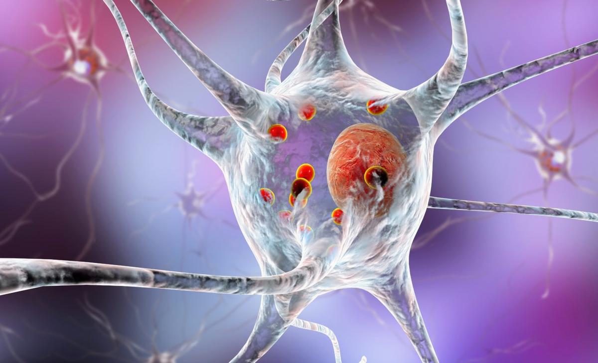 Tiny holes in brain cells may unlock the mystery of Parkinson’s