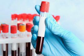 2025/09/Blood-test-health-risk.jpg