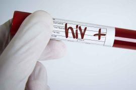 2025/09/historic-breakthrough-who-curb-hiv.jpg