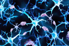 Alzheimer's,Disease,,Amyloid,Plaques,Aggregates,,3d,Illustration