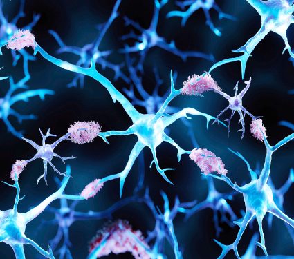 Alzheimer's,Disease,,Amyloid,Plaques,Aggregates,,3d,Illustration