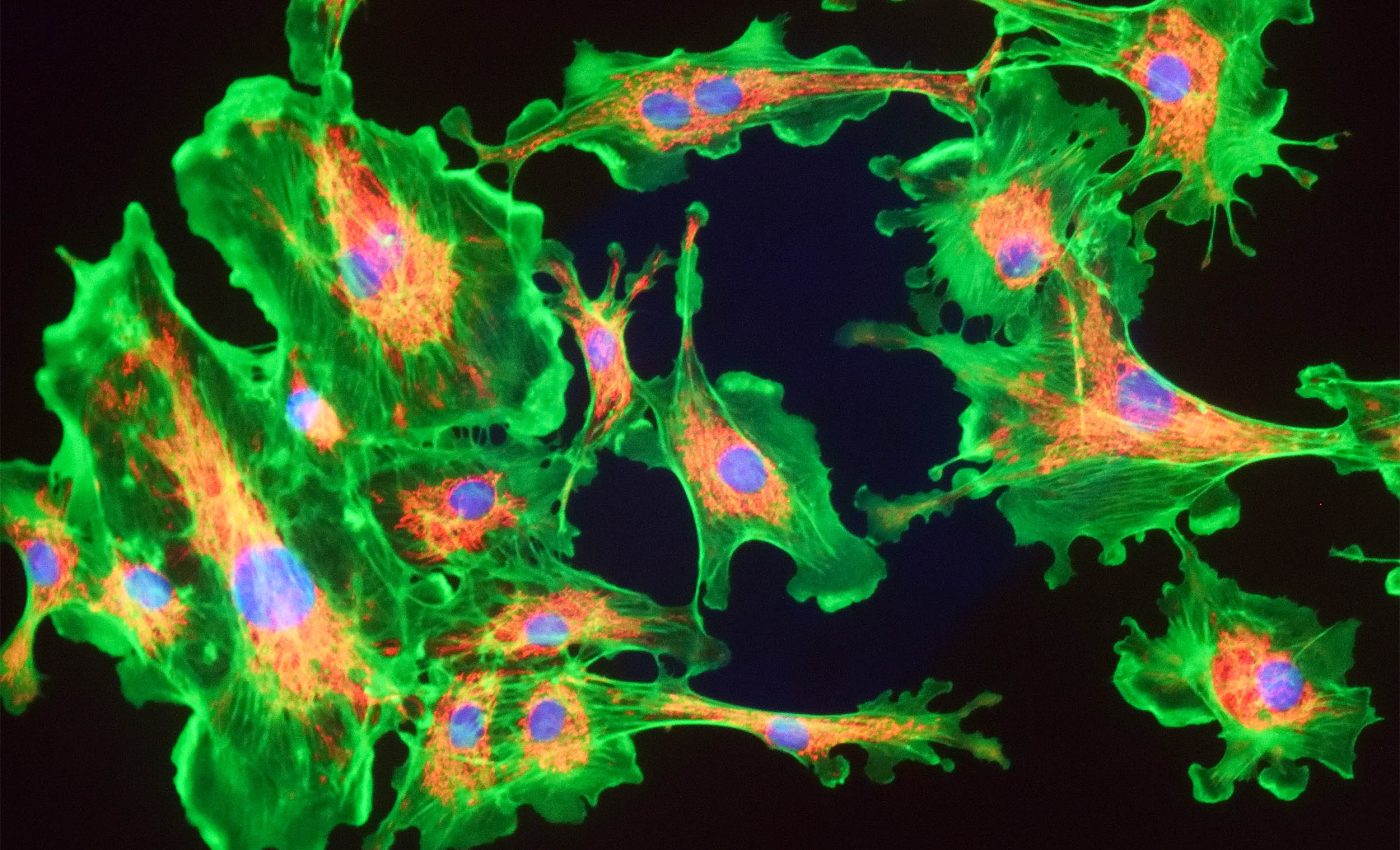 Memory loss is reversed by 'activating' the mitochondria in the brain