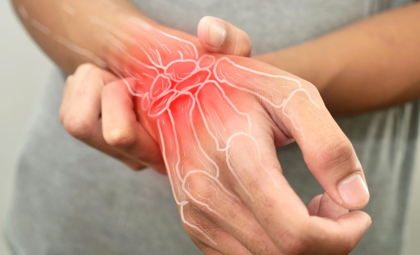 Tiny implant tames arthritis by tapping the body’s own nerve signals