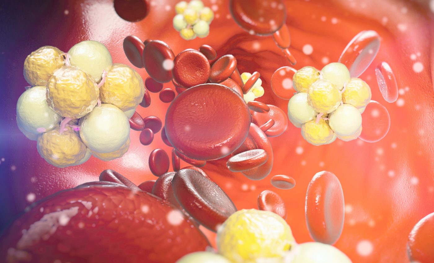 Low cholesterol may protect your brain from dementia