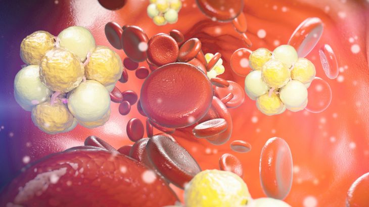 Low cholesterol may protect your brain from dementia