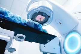 2025/10/radiation-therapy_second-cancer_1m.jpg