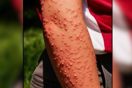2025/10/australia-fire-ant-invasion-alarm.jpg