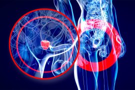 2025/10/prostate-cancer_brca_treatment_1m.jpg