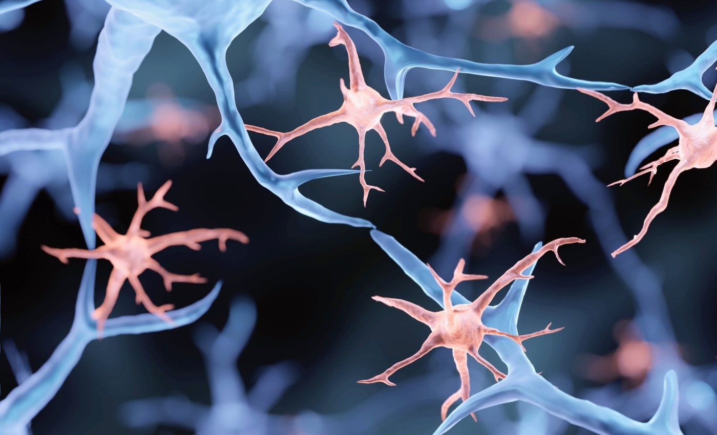 Eating fewer calories helps the aging brain rewire itself