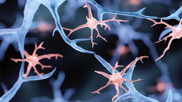 Eating fewer calories helps the aging brain rewire itself