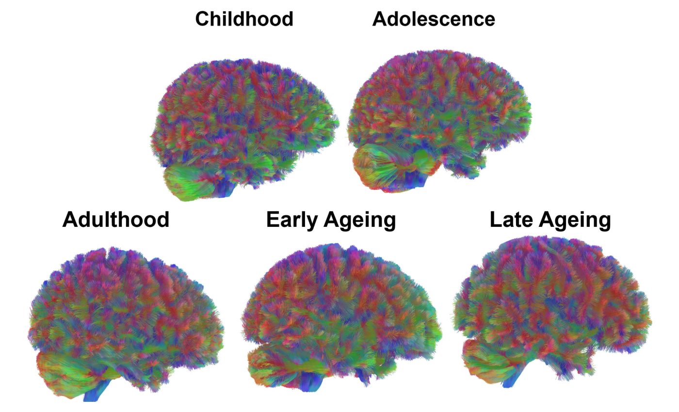 Scientists map five different stages of human aging throughout life