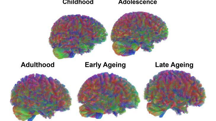 Scientists map five different stages of human aging throughout life